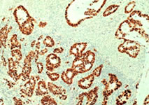 ICC P53